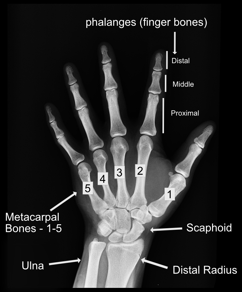 x-ray-hand